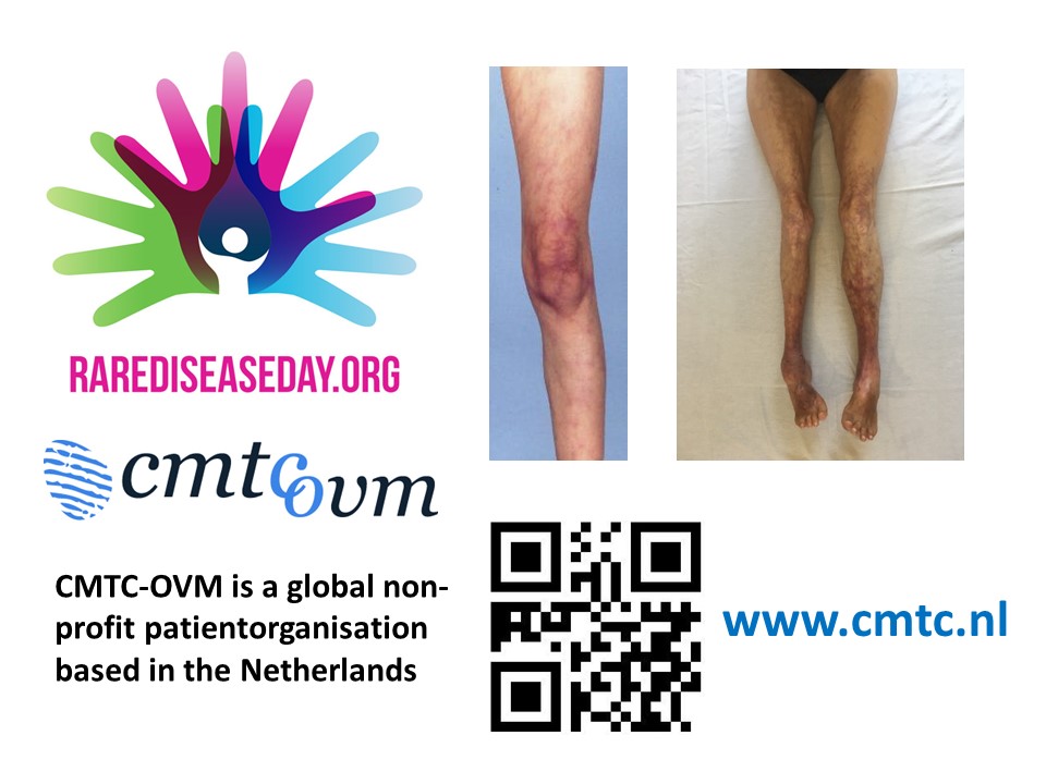 cmtc-ovm-zzd-2020-poster Rare diseases day