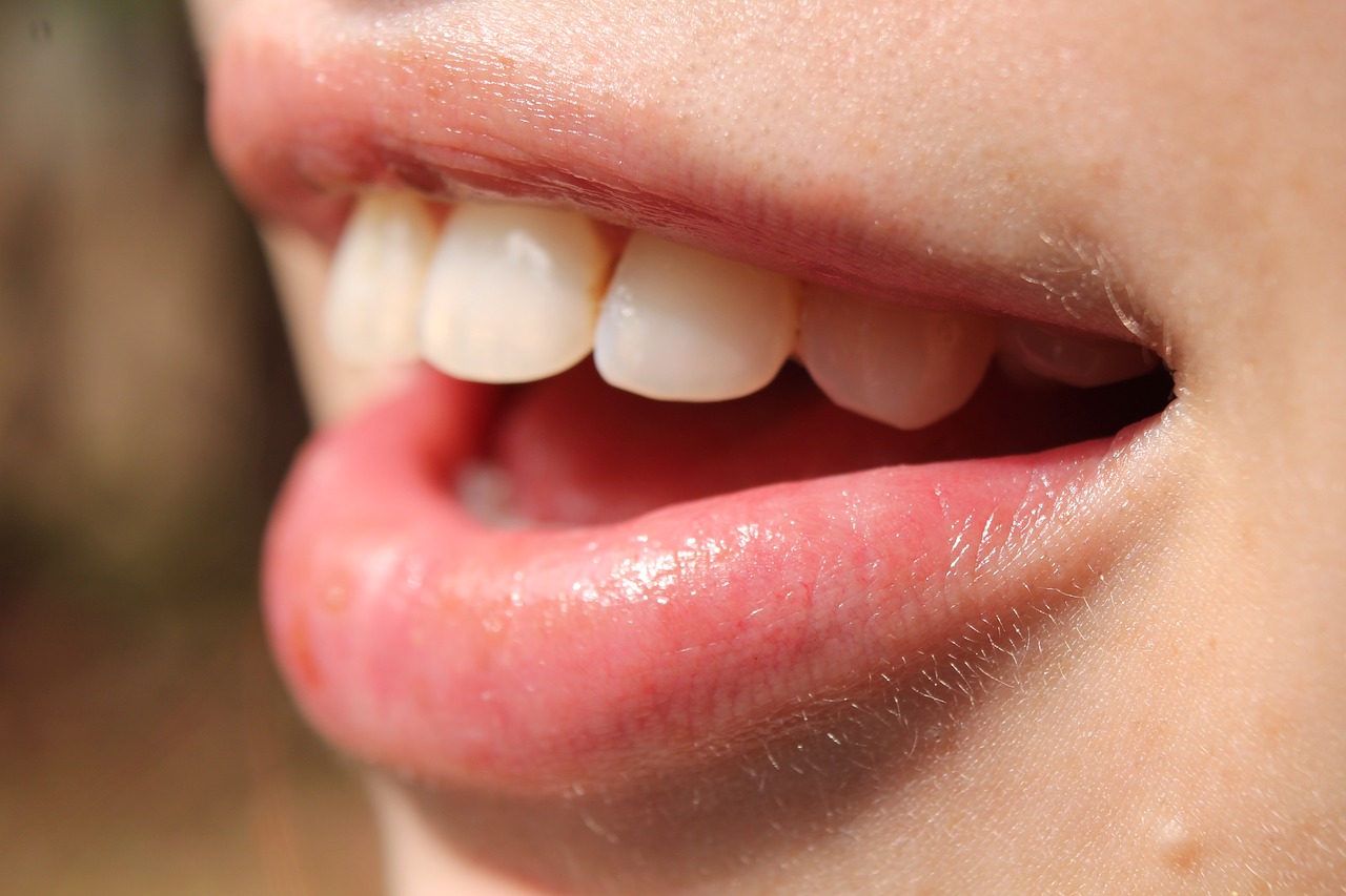 mouth-2791895_1280 mouth-2791895_1280