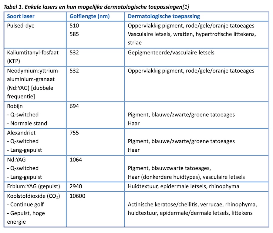 tabel-1-enkele-lasers